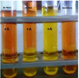 Gambar 4.  Hasil uji fermentasi fruktosa (- = tidak terjadi fermentasi ; +A = terjadi fermentasi menghasilkan asam) 