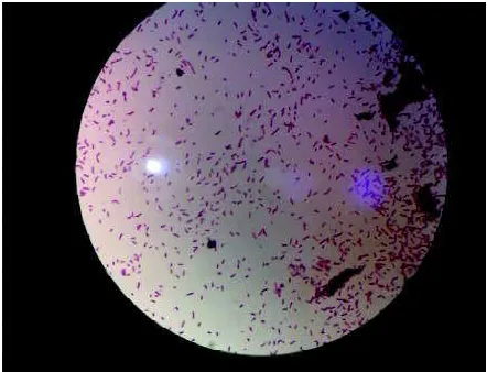 Gambar 4. Pengamatan Mikroskopik Escheri-chia coli