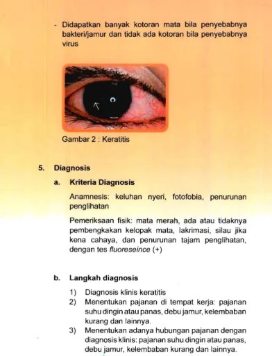 Gambar 2 : Keratitis 
