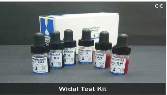 Gambar 4. Widal Test Kit. (Sumber: Maulana, 2011) 