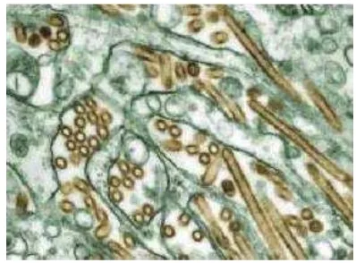 Gambar 1. Mikograf Elektron berwarna dari penularan virus flu burung A H5N1 (terlihat