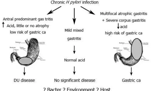 Gambar 2.5. Respon Terhadap Infeksi H. pylori. Sumber: Smith, M.G., Hold 