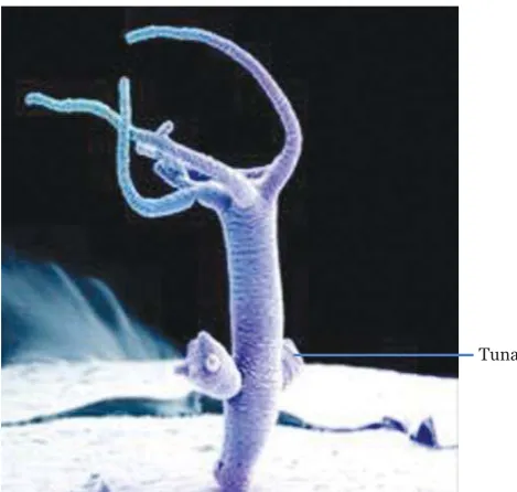 Gambar 2.10Tunas pada Hydra