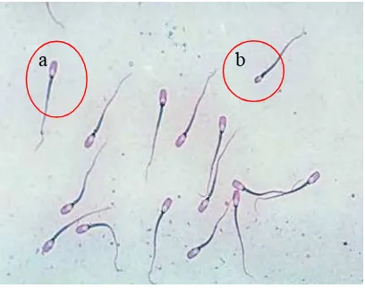 Gambar 9  Spermatozoa babi hasil pewarnaan Williams: (a) Spermatozoa normal, (b) Spermatozoa abnormal pada kepala, dan (c) Spermatozoa abnormal pada ekor 