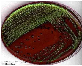 Gambar 2. Koloni bakteri E. coli (Pelczar dan Chan, 2006) 