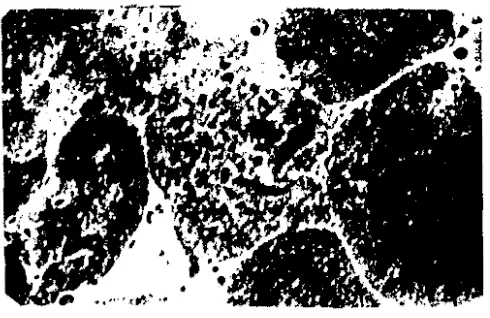 Gambar 1. Kromosom tanaman  semangkd tetraploid (4N  44) 