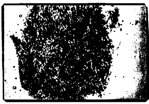 Gambar 3. Kromosom tanal11an semangka mixoplo1d (5N; Ｓｎｾ＠2N) 