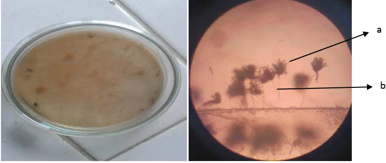 Gambar 1. .Aspergillus sp koloni umur 7 hari pada media PDA, Spora (a),    Tangkai Konidia (b) 