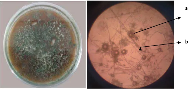 Gambar 3. Trichoderma sp koloni umur 7 hari pada media PDA, Spora (a), Tangkai Konidia (b) 