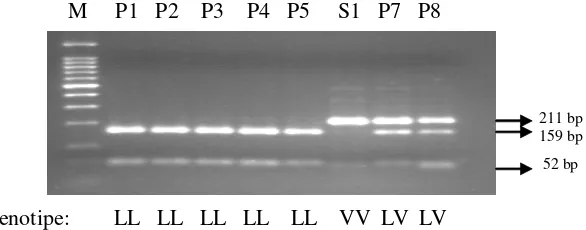 Gambar 1. Elektroforesis produk PCR-RFLP gen hormon pertumbuhan menggunakan enzimpemotong MspI