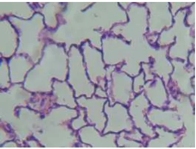 Gambar 4. Gambaran mikroskopis alveolus tikus putih pada kelompok kontrol  
