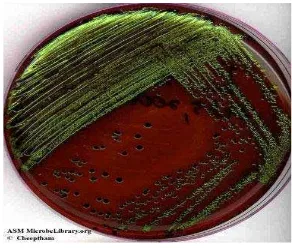 Gambar 1.  Koloni bakteri Escherichia coli (Pelczar dan Chan, 2006). 