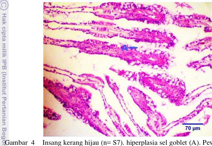 Gambar  4 Insang kerang hijau (n= S7). hiperplasia sel goblet (A). Pewarnaan 