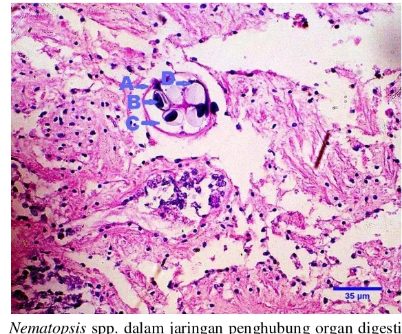 Gambar  6 Nematopsis spp. dalam jaringan penghubung organ digesti kerang 