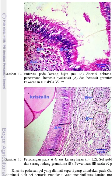 Gambar  12 Enteritis pada kerang hijau (n= L3) disertai nekrosa epitel 