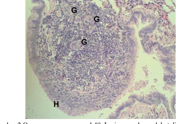 Gambar 2 Organ paru-paru sampel 49. Lesio granuloma dekat dinding 