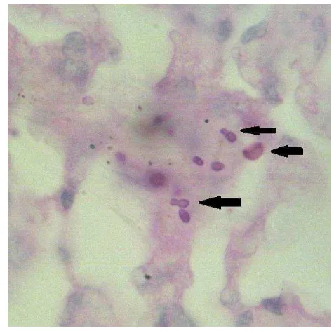 Gambar 4 Organ paru-paru sampel 53. Organisme ovoid tidak berkapsul dengan 