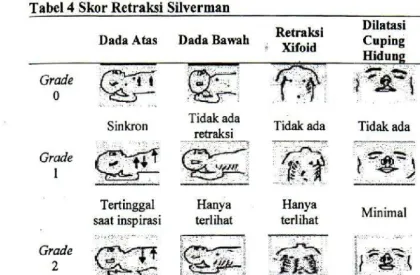 Tabel 4 Skor Retraksi Silverman