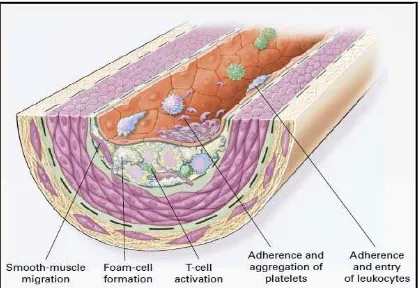 Gambar 2.2 Pembentukan fatty-streak pada proses atherosklerotik 