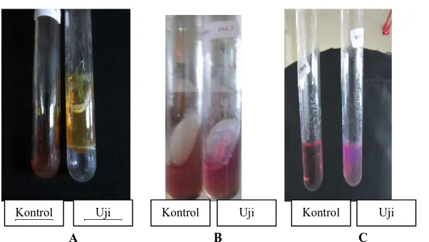 Gambar 2. Hasil uji identifikasi terhadap bakteri Escherichia coli dengan media KIA (A), LIA, (B) dan MIO (C)  