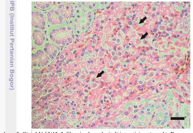Gambar   5  Ginjal U 63/13. Infiltrasi sel myelosit di interstisium (panah). Pewarnaan HE, bar = 20  