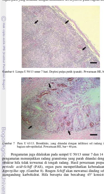 Gambar 7  Paru U 63/13. Bronkhitis, yang ditandai dengan infiltrasi sel radang (panah) pada 