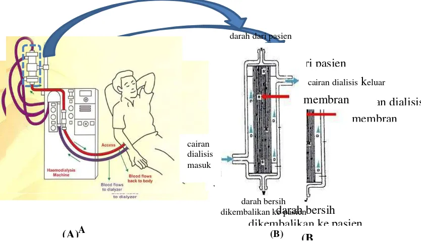 Gambar 1.3. (a). Pemurnian darah secara dialisis menggunakan mesin ginjal buatan  (sumber: www.ustudy.in) (b)