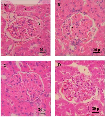 Gambar 5  Struktur mikromorfologis glomerulus tikus pada kelompok diabetik.  A,B, dan C= STZ; D= STZ+vit