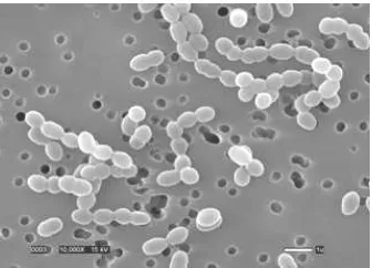 Gambar 5. Penampakkan Coccus L. mesenteroides dalam Kultur Cair (Breidt, 2004) 