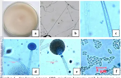 Gambar 6  Cendawan patogen CP2: miselium berwarna putih kekuningan (a), sporangiofor panjang (perbesaran 10x10) (b), hifa hialin dan tidak berseptat (perbesaran 40x10) (c), kolumela bulat (perbesaran 40x10) (d), Sporangium (perbesaran 40x10), dan sporangiospora berbentuk lonjong (perbesaran 40x10) (e) 