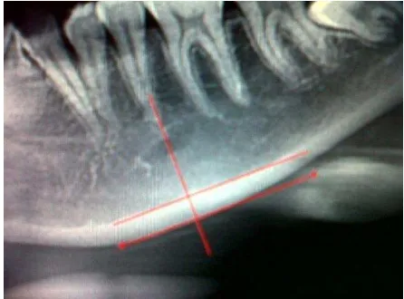Gambar 1. Tulang kortikal 15