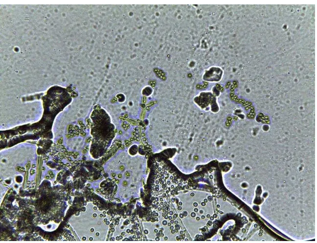 Gambar 6. T. harzianum secara mikroskopis. 