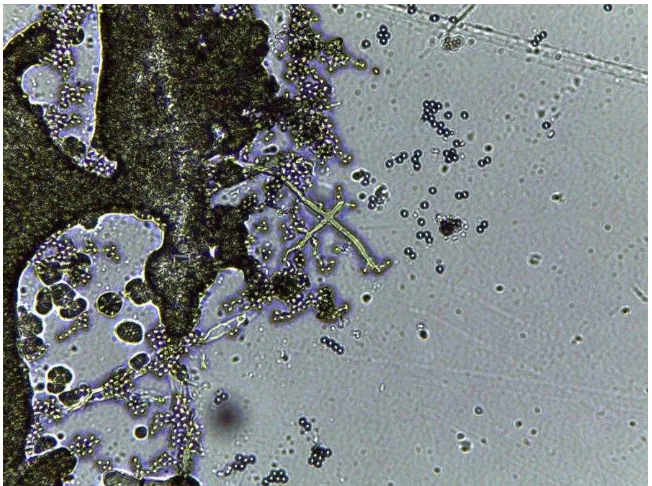 Gambar 8. T. koningii  isolat  2 secara mikroskopis. 