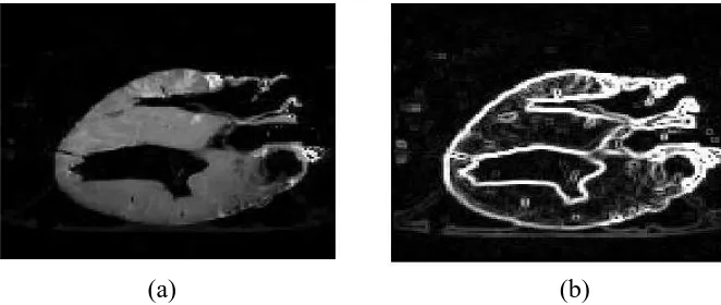 Figure 1.4: (a) Original MRI image of a dog’s heart. (b) Edge detection image. 