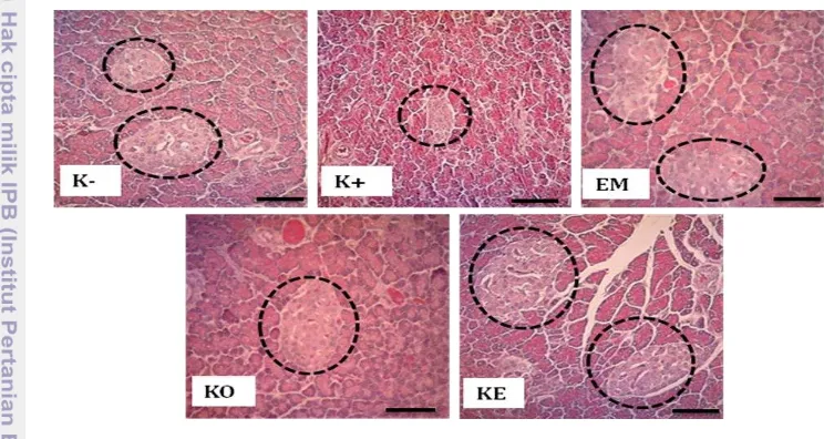 Gambar 4 Fotomikrograf jumlah pulau Langerhans jaringan pankreas tikus 