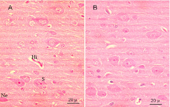 Gambar 5   Sebaran  neuron piramidal cortex cerebri tikus kelompok nondiabetik. A: kelompok kontrol; B: kelompok vitamin E; Sa: satelitosis; Ne: nekrosa neuron piramidal; Hi: hiperemi; pewarnaan HE (perbesaran objektif 40X) 