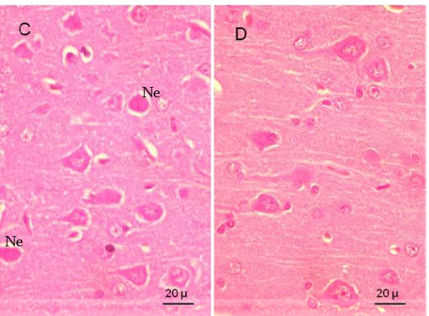 Gambar 6      Sebaran  neuron piramidal cortex cerebri tikus kelompok diabetik.  C: kelompok STZ; D: kelompok STZ+vit