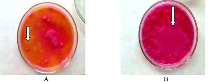 Gambar 2. A: Koloni Bacillus B :  yang memfermentasi manitol (berwarna kuning), B. cereus yang tumbuh pada media MYP, tidak memfermentasi manitol