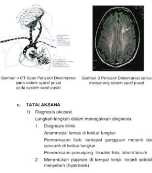 Gambar 4 CT-Scan Penyakit Dekompresi pada sistem syara! pusat 