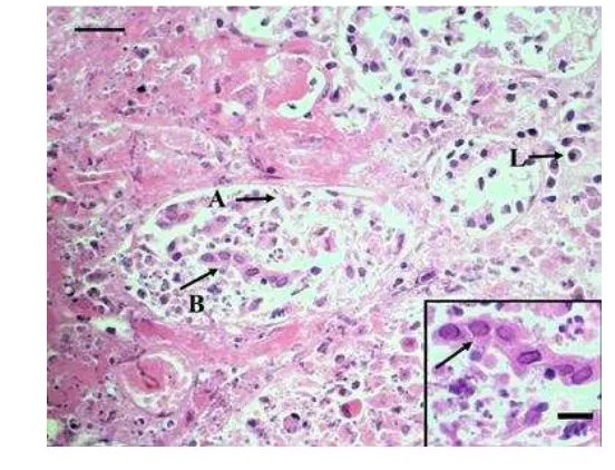 Gambar 2 Trakheobronkhitis. (A) lesio berupa nekrosis pada mukosa dan    hilangnya silia sel epitel (panah), (B) nekrosis pada submukosa, (C) tulang rawan hyalin