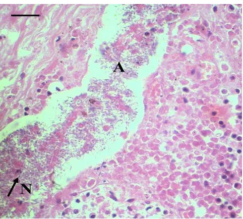 Gambar 4 Infeksi sekunder pada trakheobronkhitis. (A) koloni bakteri  coccobacilus pada mukosa trakhea, (N) infiltrasi sel radang  neutrofil (panah)