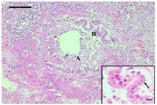 Gambar 5  Bronkhopneumonia yang ditandai dengan infiltrasi sel radang neutrofil,  makrofag, sel debris di dalam lumen bronkhiolus dan alveolus (A), badan inklusi amfofilik intranuklear pada epitel bronkhiolus (inset) (B)