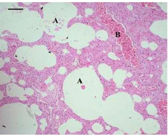 Gambar 6 Emfisema pulmonum (A), hiperemia pada kapiler paru-paru (B).   Pewarnaan HE, bar 25 m