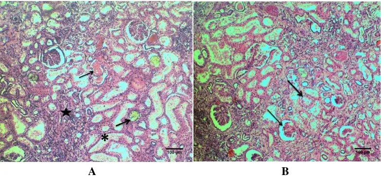 Gambar 1  Ginjal kucing urolithiasis. (A). Degenerasi hialin (anak panah), endapan  mineral di lumen tubulus (panah), dilatasi tubulus (asterik), fibrosis dan  infiltrasi sel radang (bintang)