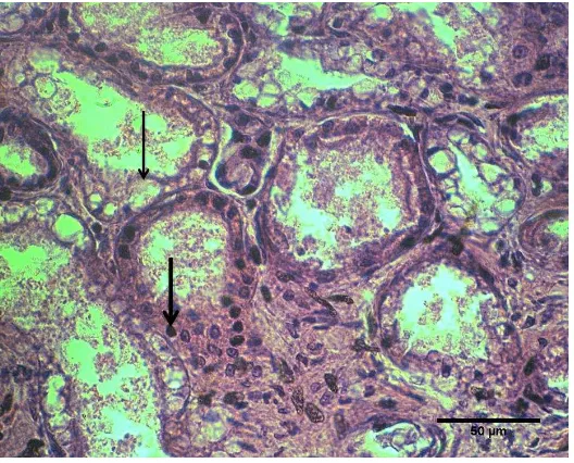 Gambar 2 Degenerasi hidropis (anak panah) pada epitel tubulus ginjal, dan tubulus ginjal yang nekrotik dengan inti piknotis (panah)
