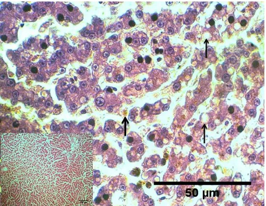 Gambar 6  Nekrosa sentrilobular hati dengan sinusoid meluas (insert), degenerasi  lemak hepatosit (anak panah) dan akumulasi pigmen hemosiderin (panah)