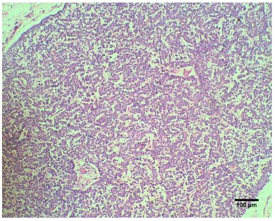 Gambar 10  Kelenjar paratiroid yang mengalami hiperplasia. Pewarnaan HE, bar 100 µm 