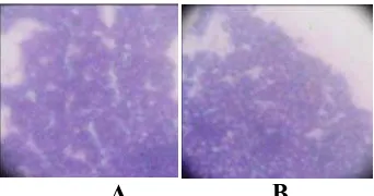 Gambar 2. Hasil Uji Identifikasi Biokimiawi dengan media Manitol Salt Agar (MSA) terhadap bakteri S.aureus Sensitif (A) dan Multiresisten (B)