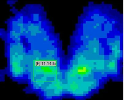 Figure 2.1: Pressure distribution of a seated person  