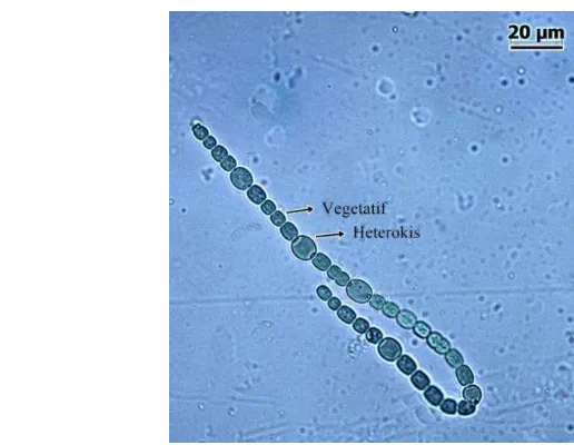 Gambar 3  Anabaena azollae dengan sel heterokis dan sel vegetatif 